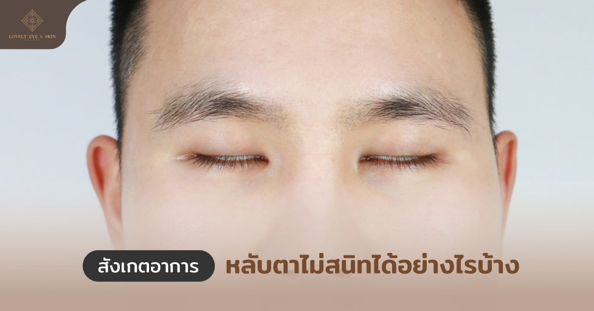 อาการหลับตาไม่สนิท ตาแห้งง่าย ตาแดงบ่อย ตาเบลอ หรือมองไม่ชัด ระคายเคืองตา และแสบตา