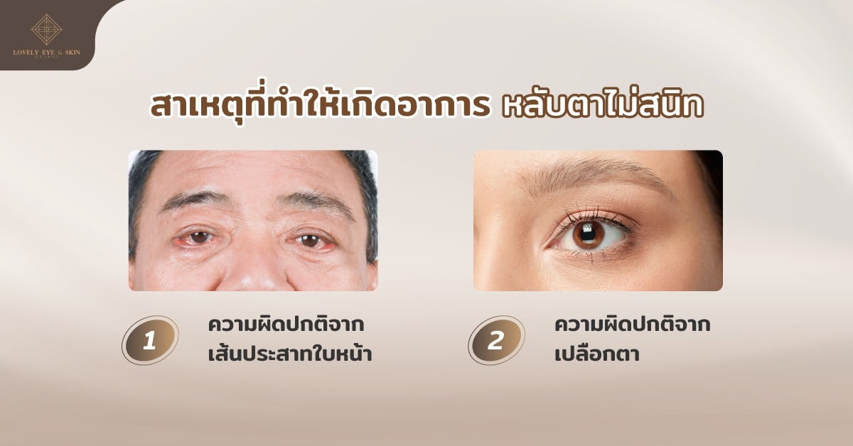 สาเหตุที่ทำให้เกิดอาการหลับตาไม่สนิท เกิดจากเส้นประสาทใบหน้า และความผิดปกติจากเปลือกตา