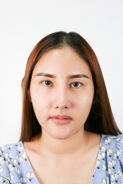 แก้ตาสองชั้น เปิดหัวตา