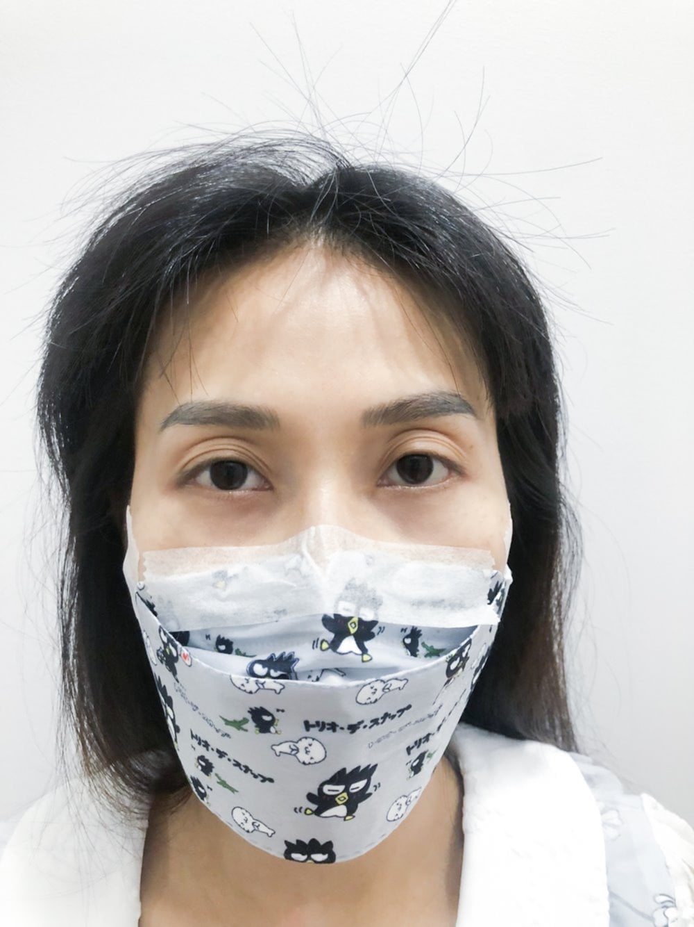 ทำตาสองชั้น เปิดหัวตา ดึงกล้ามเนื้อตา เติมไขมันตา
