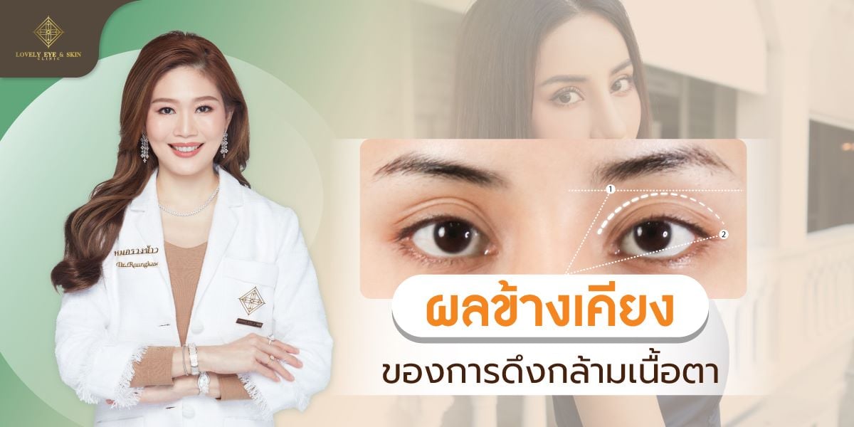 กล้ามเนื้อตาลีเวเตอร์อ่อนแรง ส่งผลให้ดวงตาดูปรือ ดูง่วงนอน