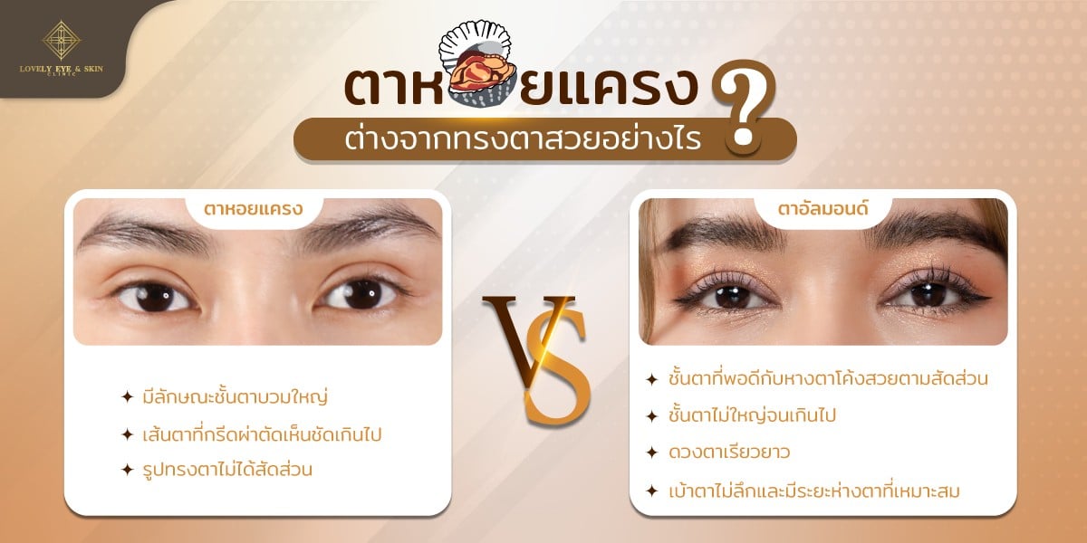 ตาหอยแครงต่างจากตาสวย คือ ชั้นตาไม่ใหญ่จนเกินไป เบ้าตาไม่ลึกและมีระยะห่างตาที่เหมาะสม
