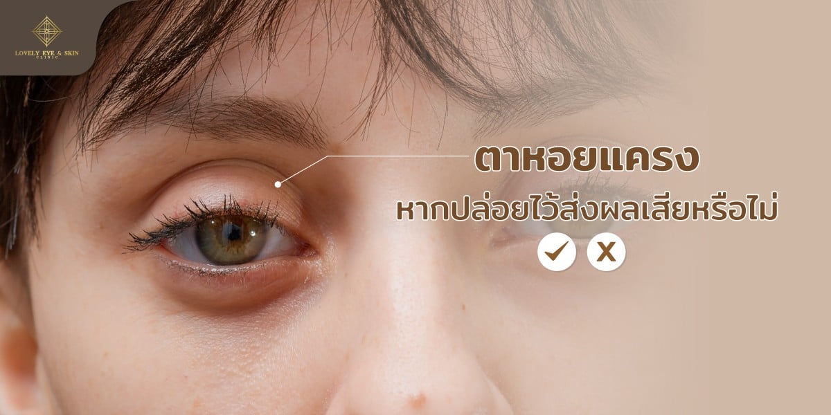 swollen-eyes-3.jpg