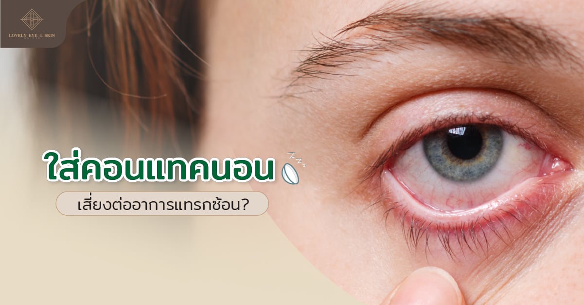 การใส่คอนแทคนอน เสี่ยงต่ออาการแทรกซ้อนใดบ้าง
