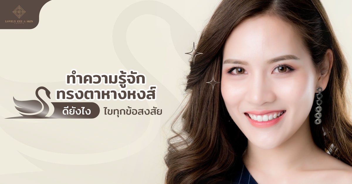 ทำความรู้จัก ตาหางหงส์ ดียังไง