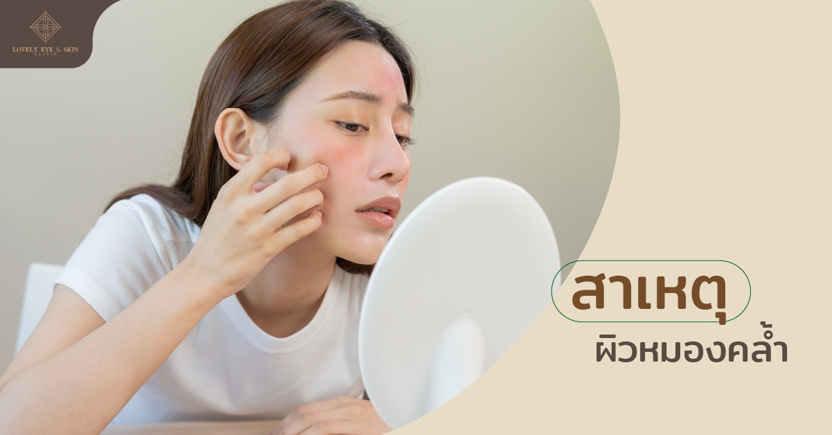 สาเหตุที่ผิวหมองคล้ำเกิดจากอะไร ?