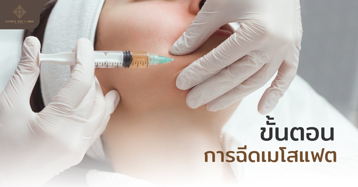 ขั้นตอนการฉีดเมโสแฟต