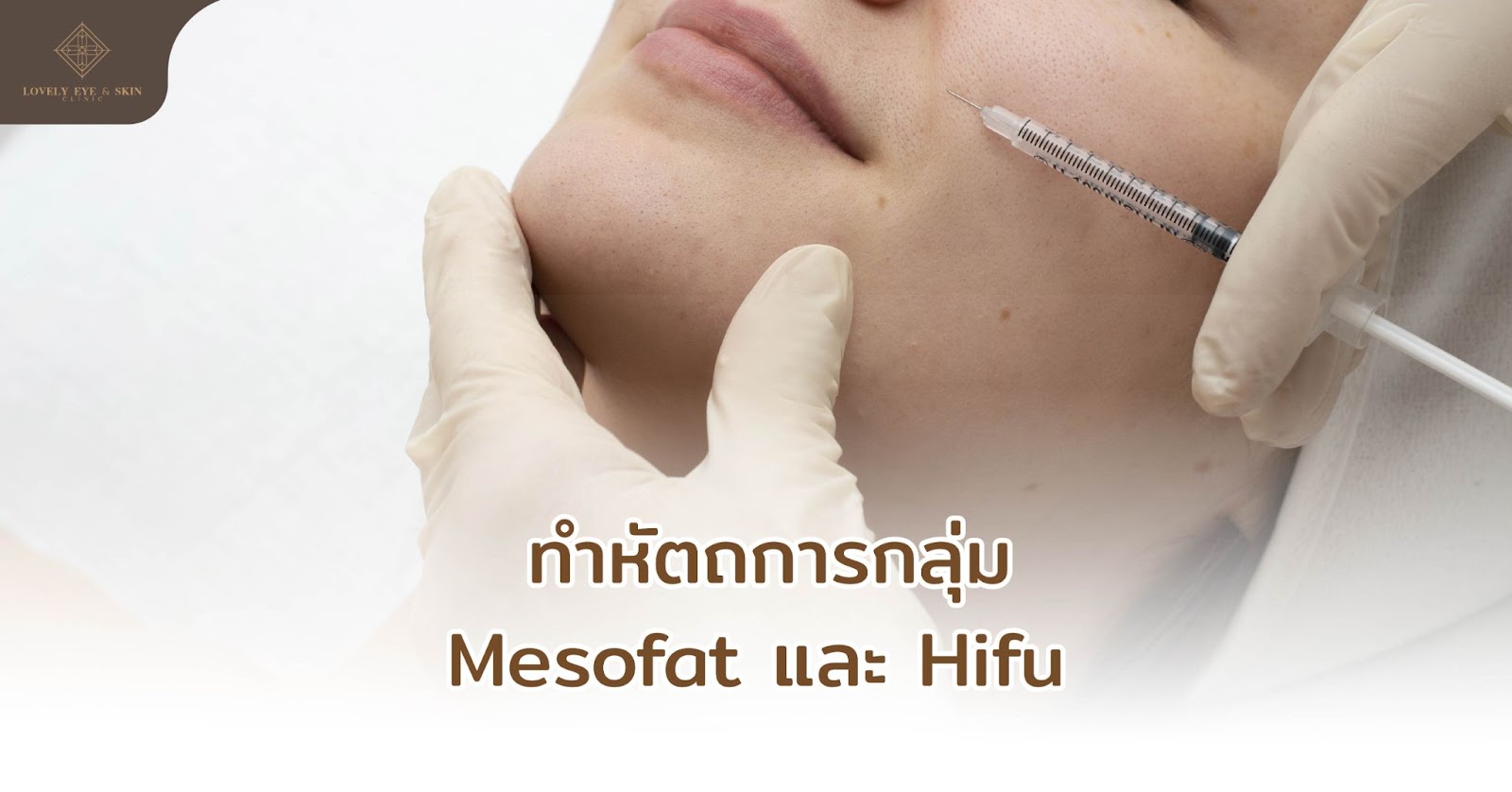 ยกกระชับใบหน้า โดยทำหัตถการกลุ่ม ฉีดสารกระตุ้น