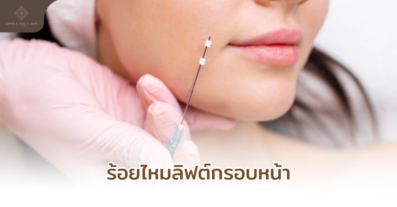 ยกกระชับหน้า ด้วยการร้อยไหมเพื่อกระตุ้นคอลลาเจน ฟื้นฟูผิวให้เรียบเนียน เต่งตึง