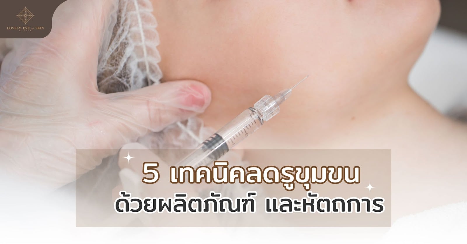 เทคนิคลดรูขุมขนด้วยผลิตภัณฑ์ และหัตถการ