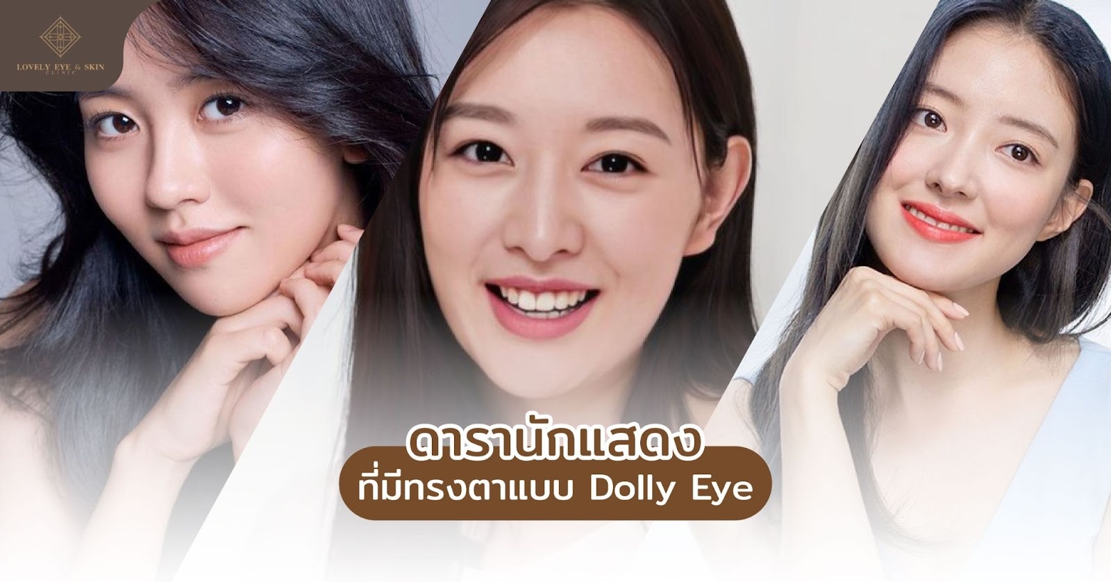 ดารานักแสดงที่มีทรงตาแบบ Dolly Eye