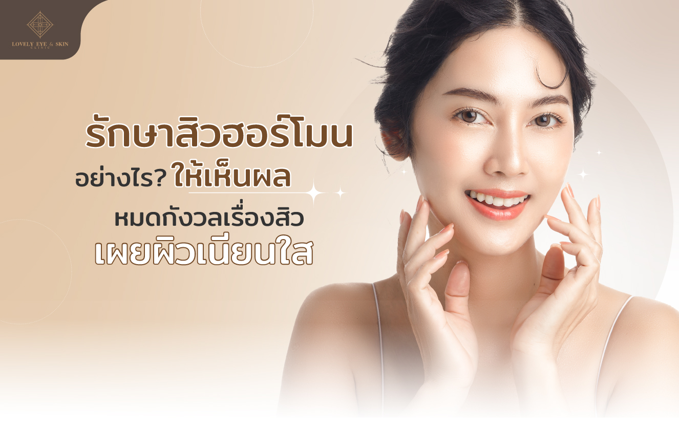 รักษาสิวฮอร์โมนอย่างไร ให้ได้ผล หยุดวงจรสิวฮอร์โมน ให้หน้าเนียนใส