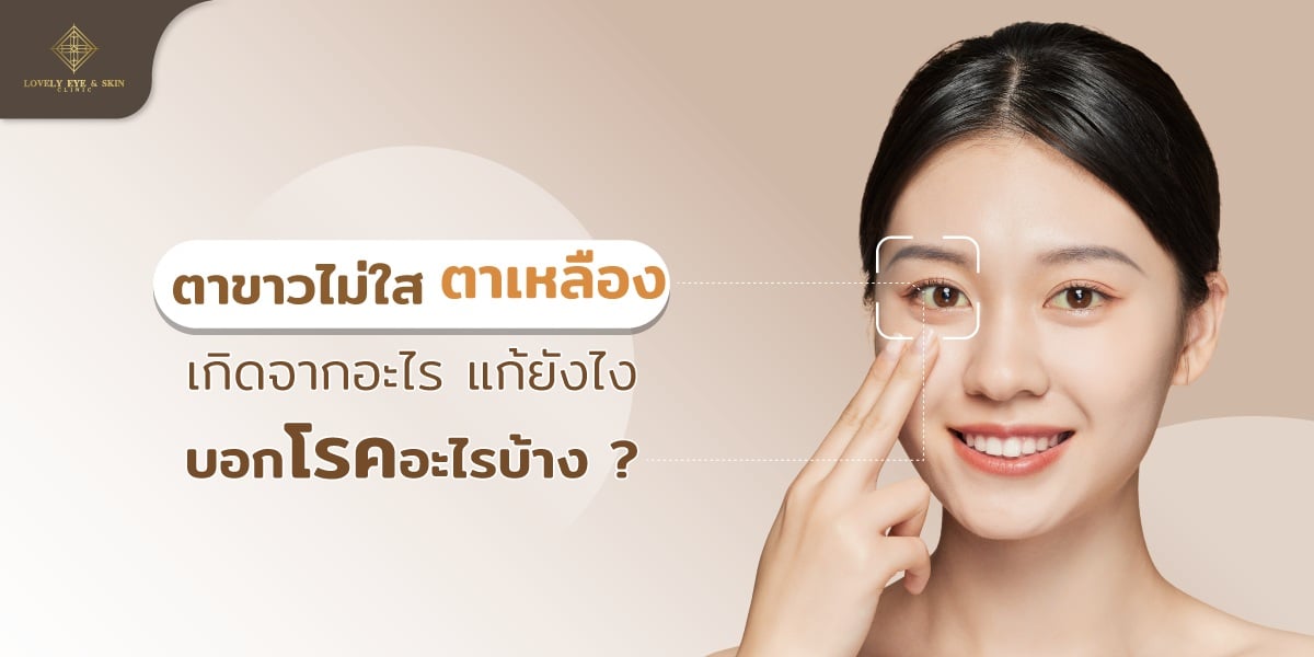 ตาเหลือง ไม่ใส เกิดจากอะไร แก้ยังไง