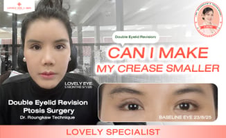 make eyelid crease smaller