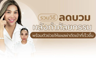 ลดบวมหลังทำศัลยกรรม
