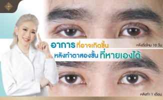 หลังทำตาสองชั้น