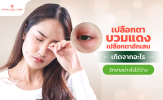 เปลือกตาอักเสบ