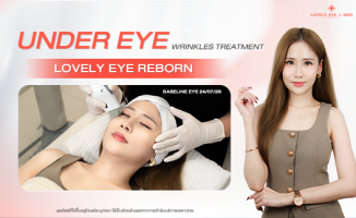 Under eye wrinkles treatment