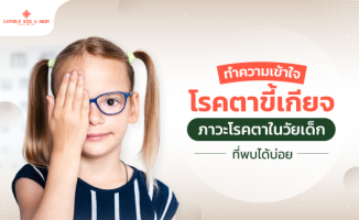 ตาขี้เกียจ คือ