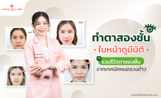 ทำตาสองชั้นใบหน้าดูมีมิติ รวมรีวิวตาสองชั้นจากเทคนิคหมอรวงข้าว