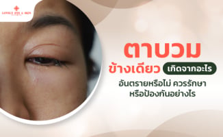 ตาบวมข้างเดียวเกิดจากอะไร อันตรายหรือไม่ ควรรักษาหรือป้องกันอย่างไร