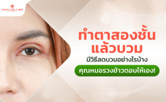 วิธีลดบวมหลังทำตา ทำตาสองชั้นตาบวมนาน