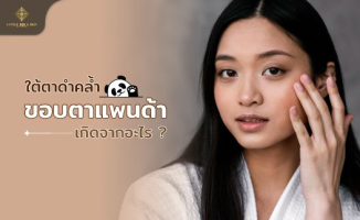 ใต้ตาคล้ำ