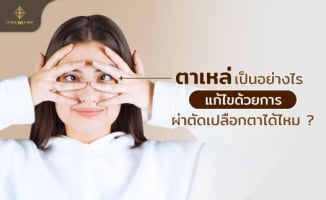 ตาเหล่ ตาเข