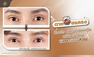 ตอหอยแครง