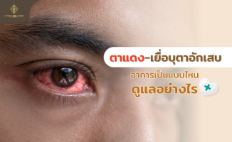 เยื่อบุตาอักเสบ