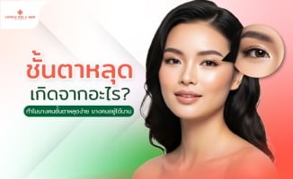 ชั้นตาหลุดเกิดจากอะไร? ทำไมบางคนชั้นตาหลุดง่าย บางคนอยู่ได้นาน