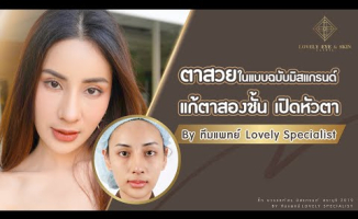 Embedded thumbnail for มิสเเกรนด์ มาแก้ตาสองชั้น ที่เคยทำจากที่อื่น l Lovely Eye &amp;amp; Skin Clinic