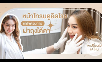 Embedded thumbnail for คุณชมพู่ นักข่าว NBT ถุงใต้ตาบวม!! มาผ่าถุงใต้ตา l Lovely Eye &amp;amp; Skin Clinic
